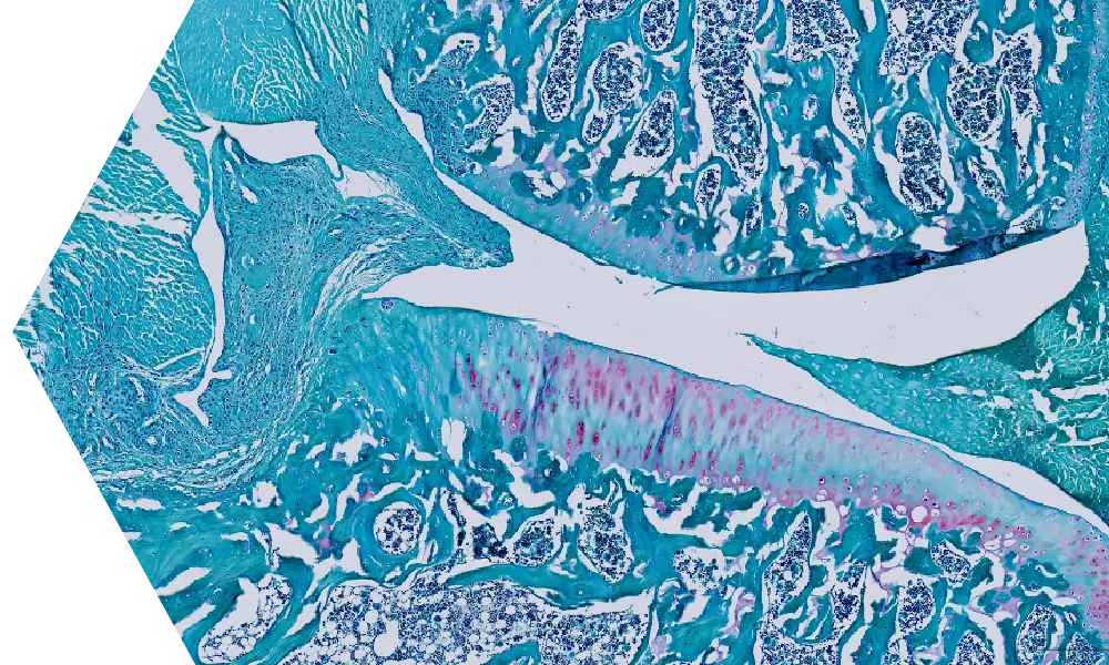 Regenerative Medicine